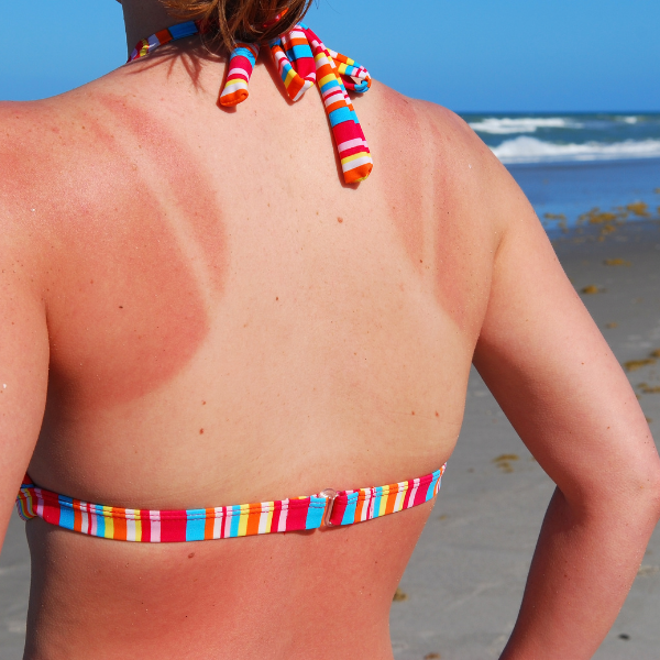 iv-therapy-1-877857 iv therapy 1 877857