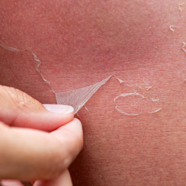 iv-therapy-5-877857 iv therapy 5 877857