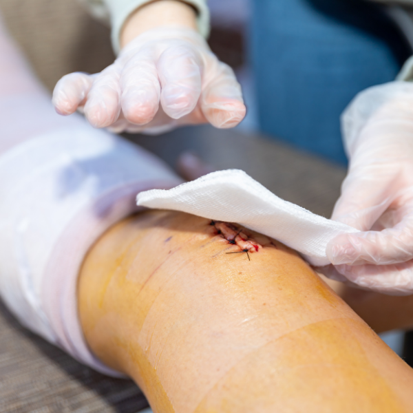 iv-therapy-83-8879 iv therapy 83 8879